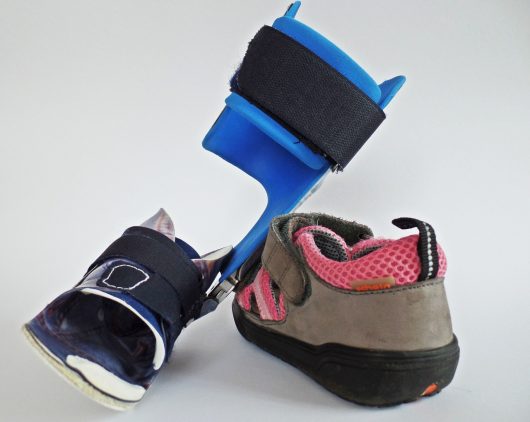 orthosis-449685-1280